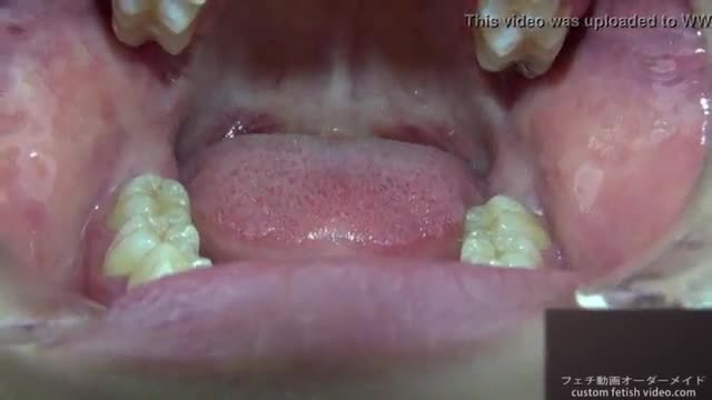Teeth fetish